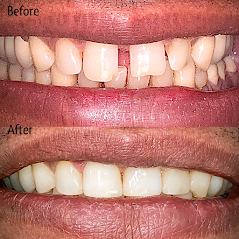 King George Dental Center Before and After Photos