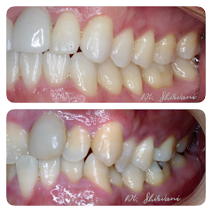 King George Dental Center Before and After Photos