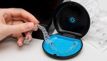 Invisalign an Excellent Alternative to Correct Malocclusion with Braces without Metal