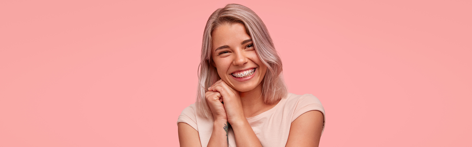 How Long Do Traditional Braces Take?